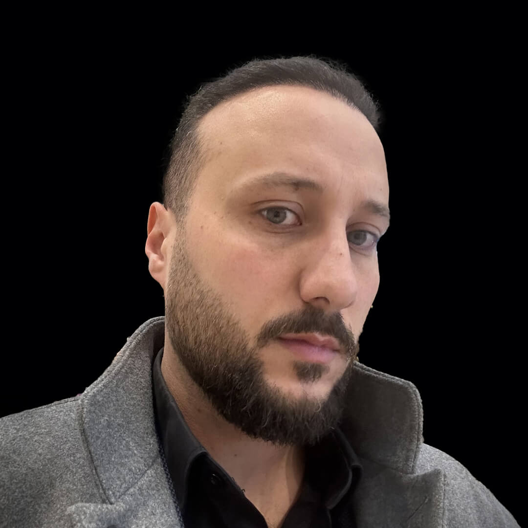 hair transplant gallery 6