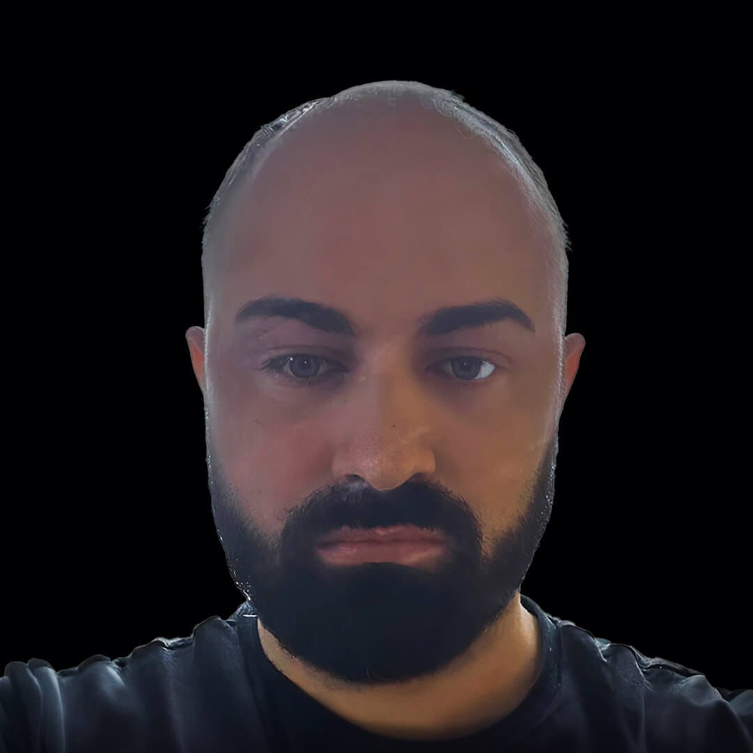 hair transplant gallery 7
