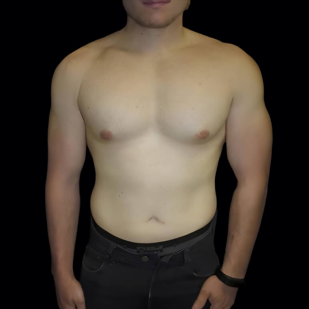 sixpack gallery 1
