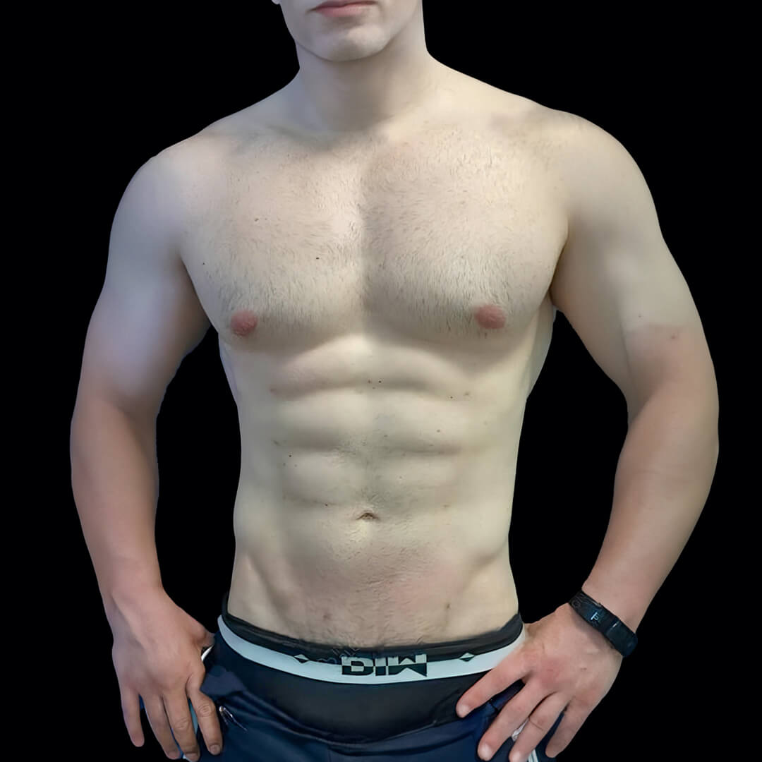 sixpack gallery 2