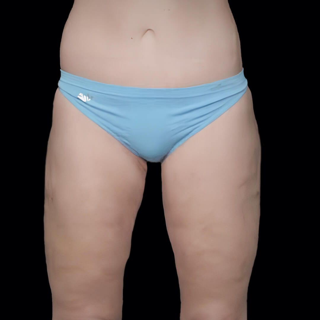thigh gallery 2