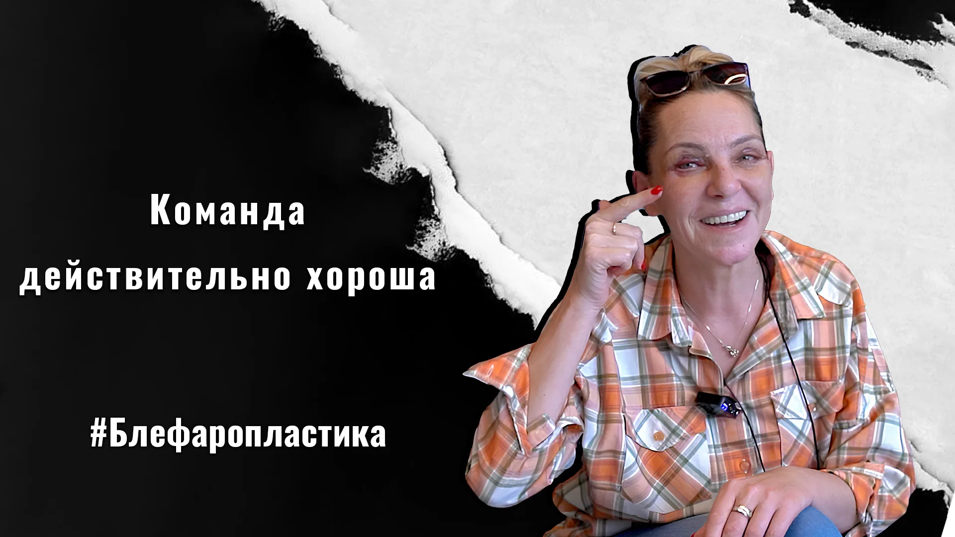 Блефаропластика-век-в-Стамбуле-Турция