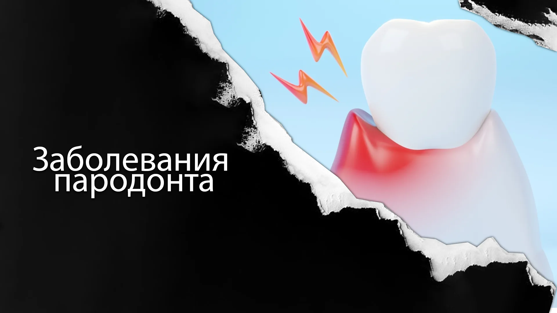 Кому-подходит-пародонтология