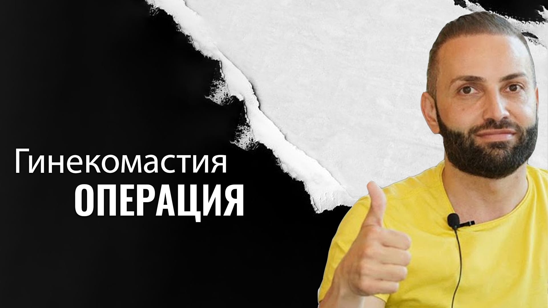 Кому-показана-гинекомастия