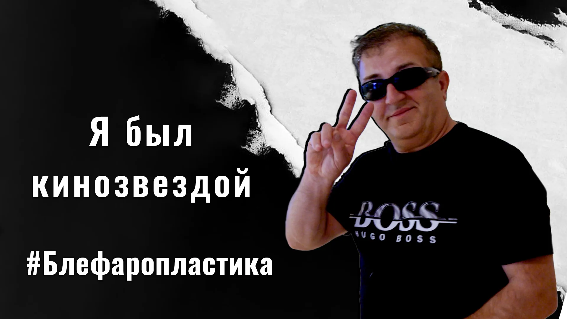 Кому-показана-операция-на-веках