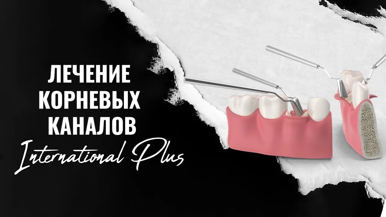 Кто-имеет-право-на-эндодонтию