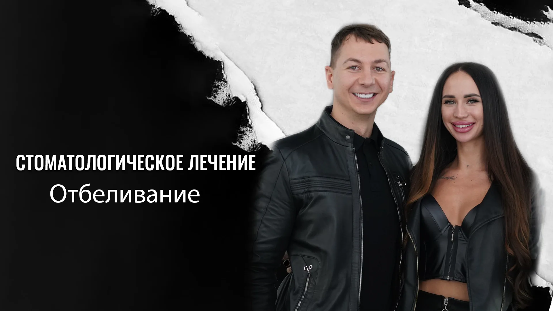 Отбеливание-зубов-в-Стамбуле-Турция