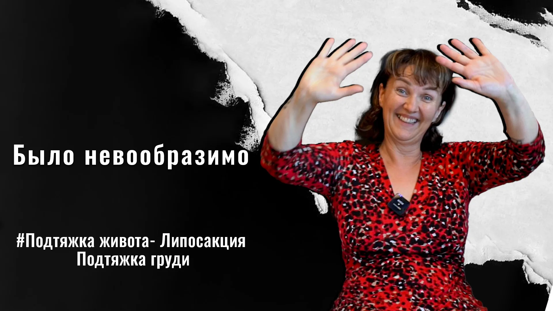 Подтяжка-груди-в-Стамбуле-Турция