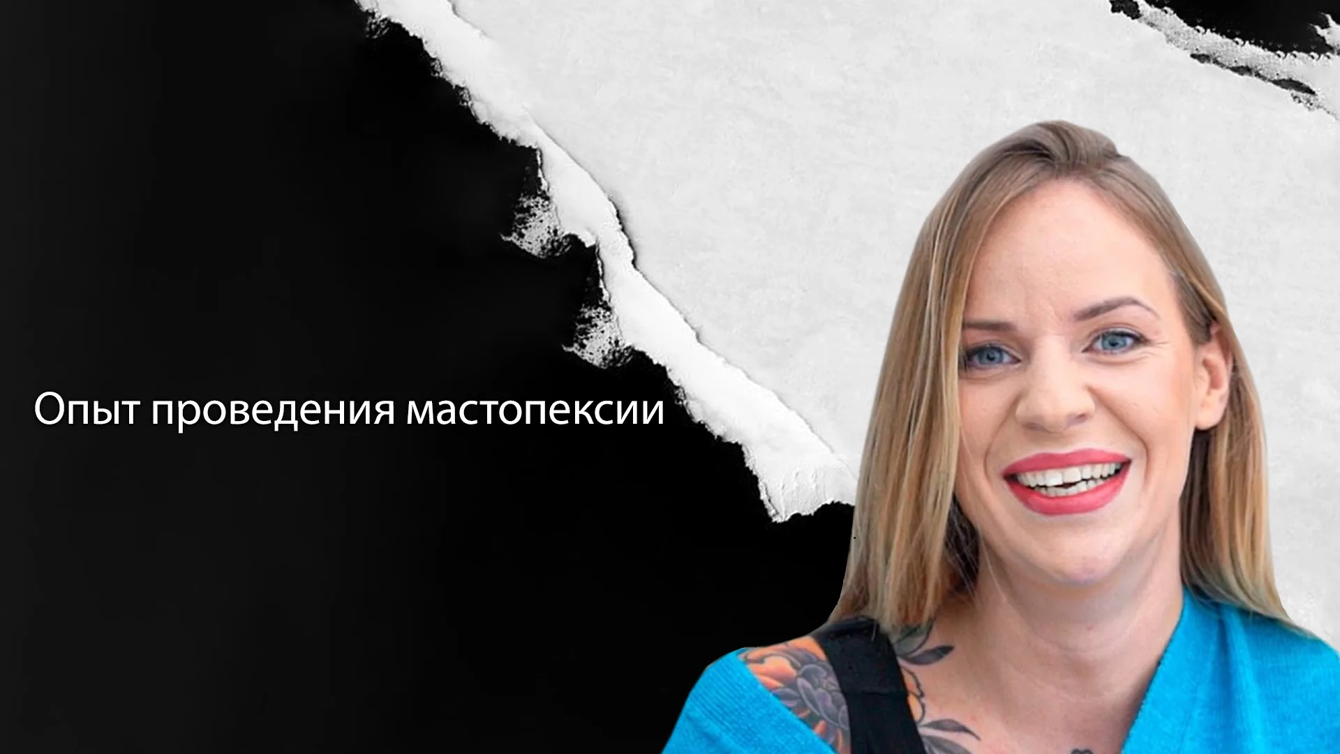 Увеличение-груди-в-Стамбуле-Турция