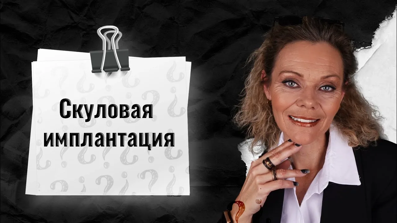 Что-такое-скуловой-имплант