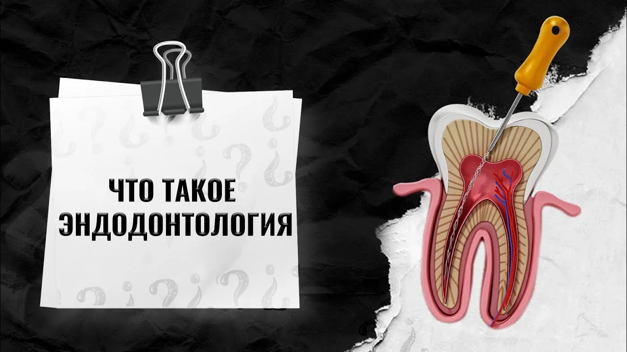 Эндодонтия-в-Стамбуле-Турция