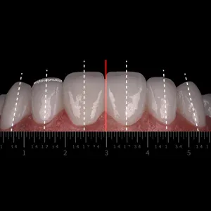 Get younger with Digital Smile Designv