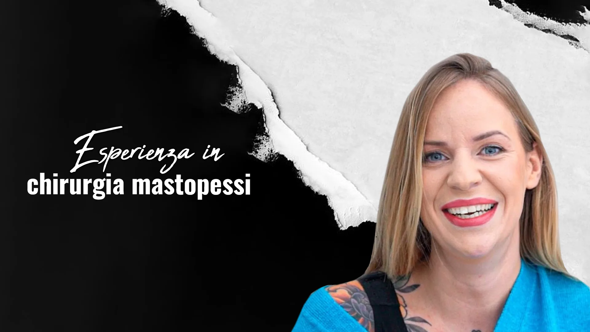 Mastoplastica-additiva-a-Istanbul-Turchia