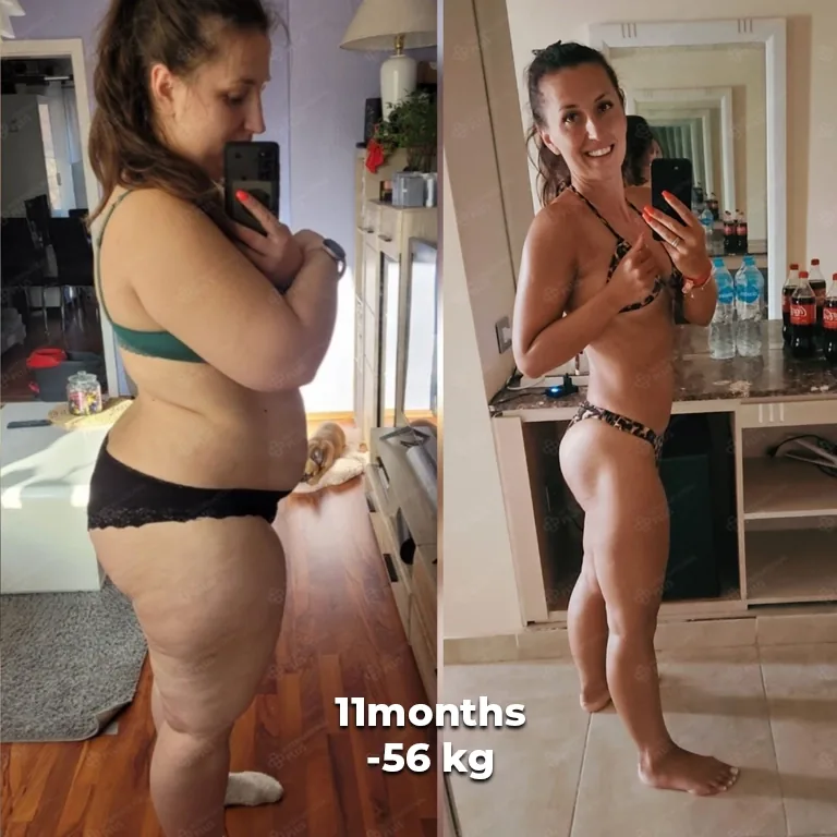 bariatric surgery before after 21
