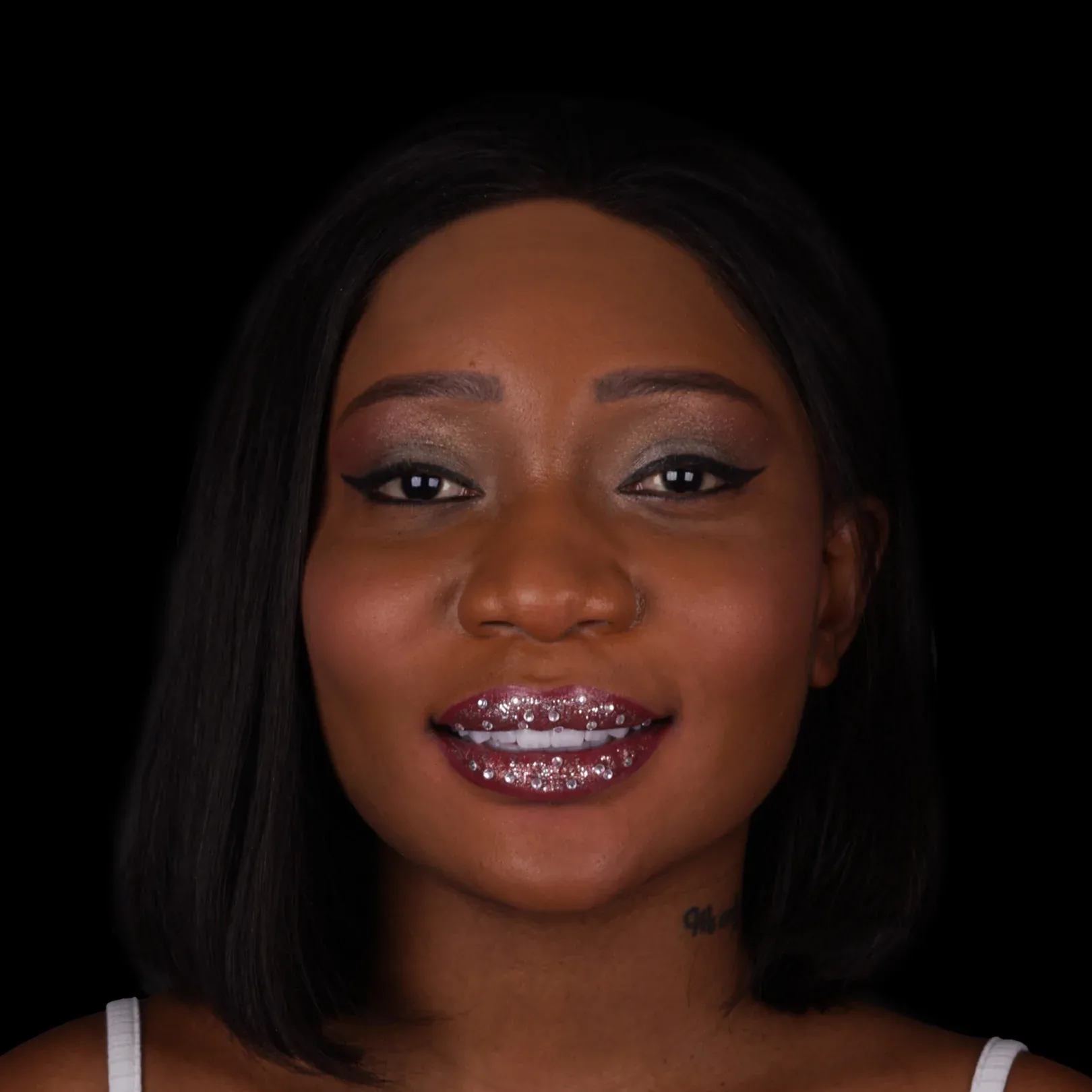 hollywood-smile-before-after-1 hollywood smile before after 1