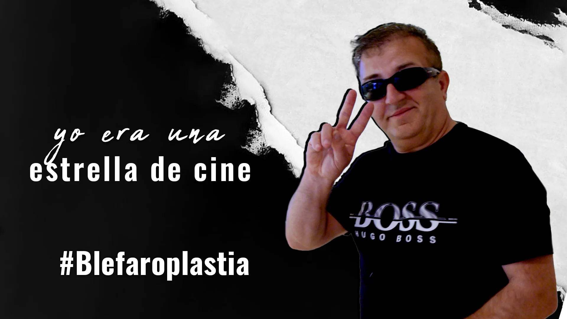 ¿Quien-califica-para-la-blefaroplastia_