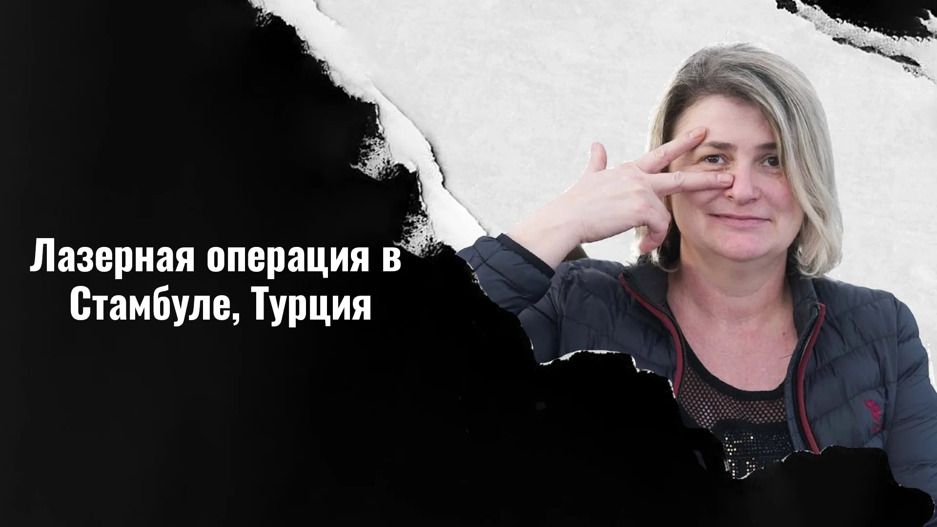 Лазерная-операция-в-Стамбуле-Турция