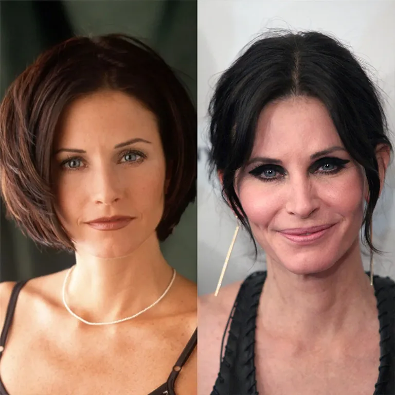 Courteney Cox Fillers Story