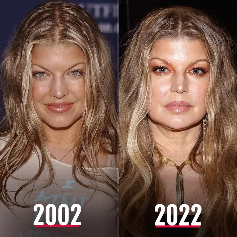 Fergie Aesthetic Transformation Rediscovering Herself