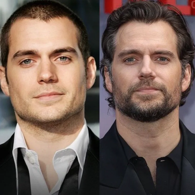 How Can You Naturally Enhance Your Jawline