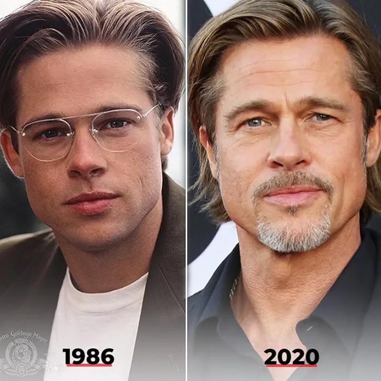 What is Jawline Definition, and Why is it Important