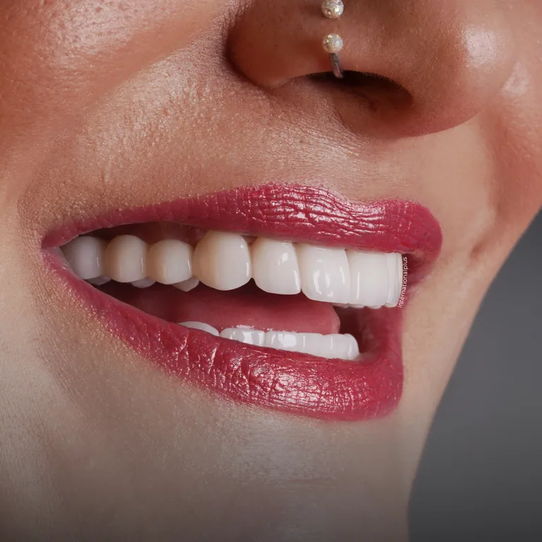 Comparing Swiss Implants with Other Top Dental Implant Systems