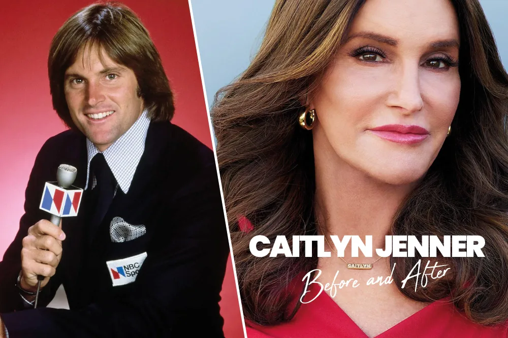 Caitlyn Jenner Before and After