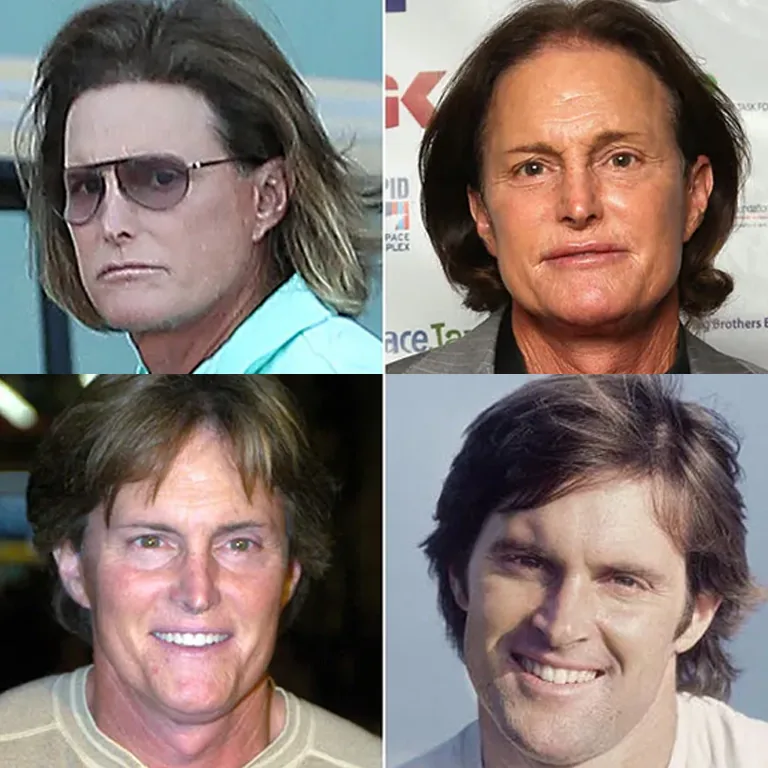 Caitlyn Jenner Influence on Transgender Visibility in the Media