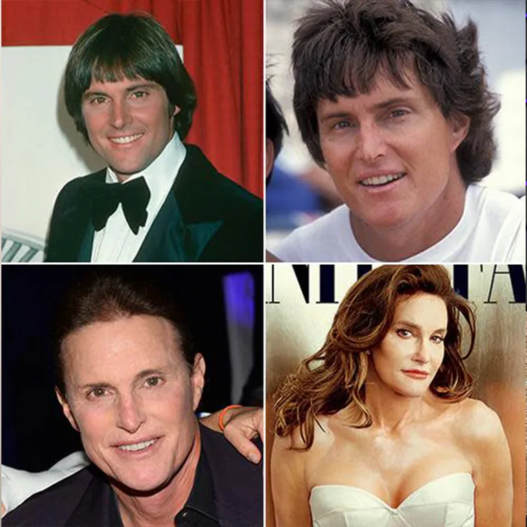Caitlyn Jenner Skin and Facial Softening A Youthful Glow