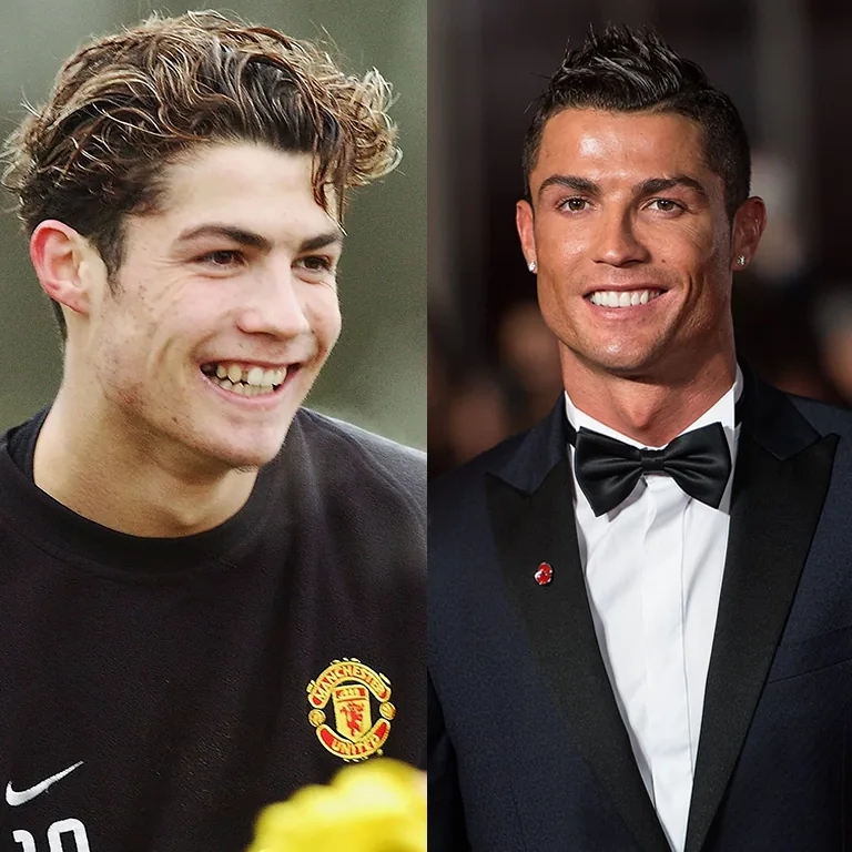 Cristiano Ronaldo Before and After