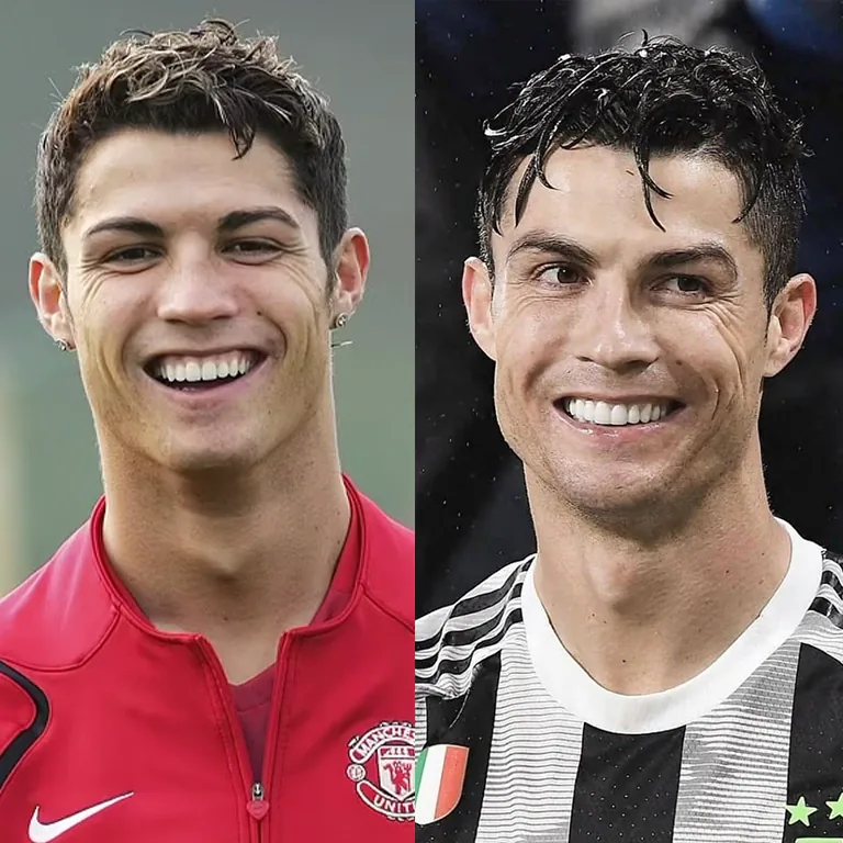 Cristiano Ronaldo Dental Implant Cost How Much Would His Smile Transformation Be