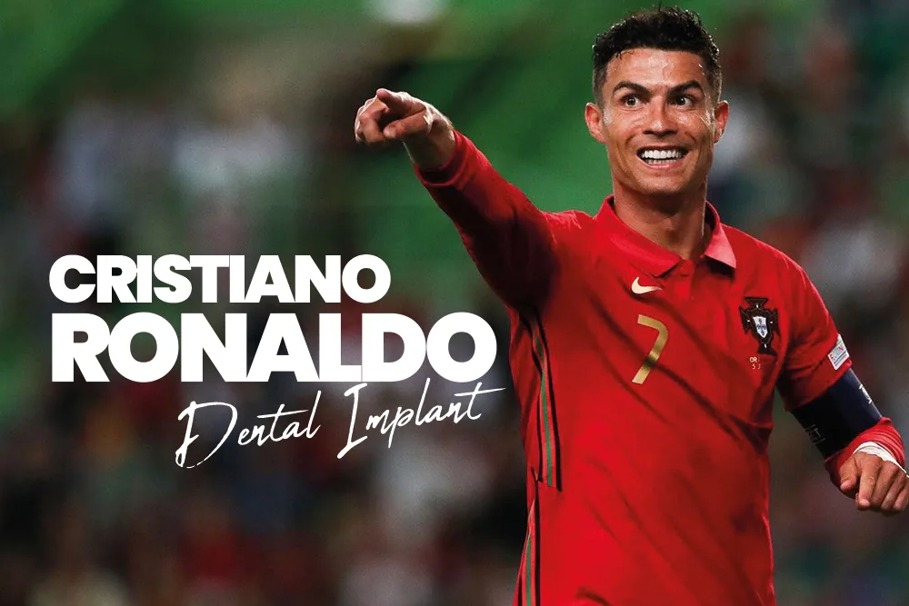Cristiano Ronaldo Dental Implant