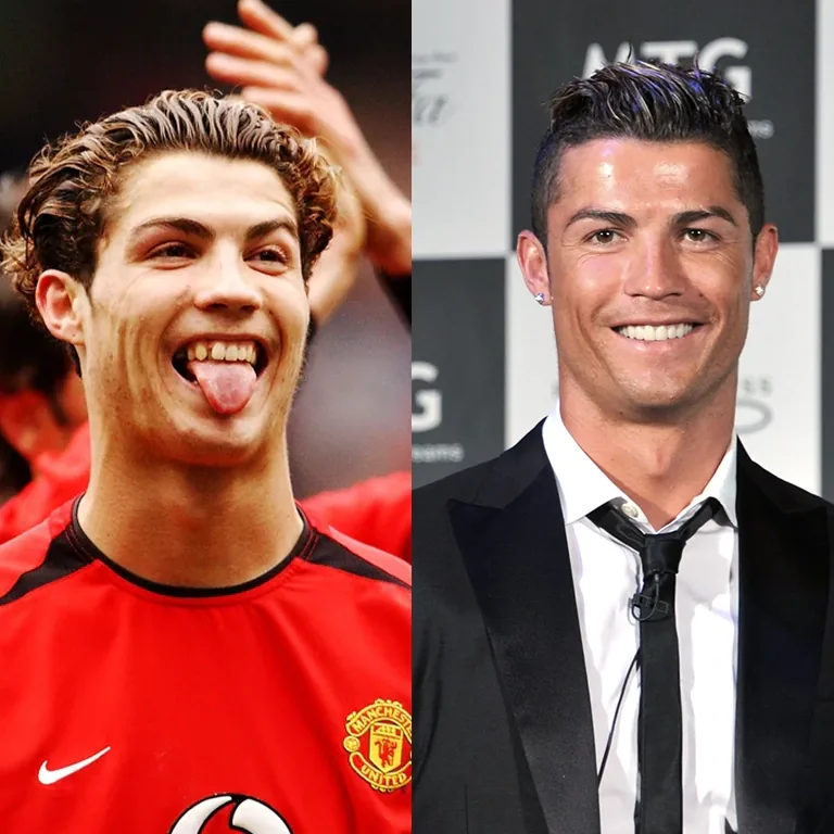 Cristiano Ronaldo Dental Work