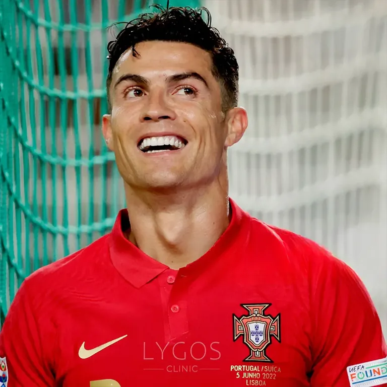Cristiano Ronaldo Veneers vs. Implants Which Procedure Did He Choose