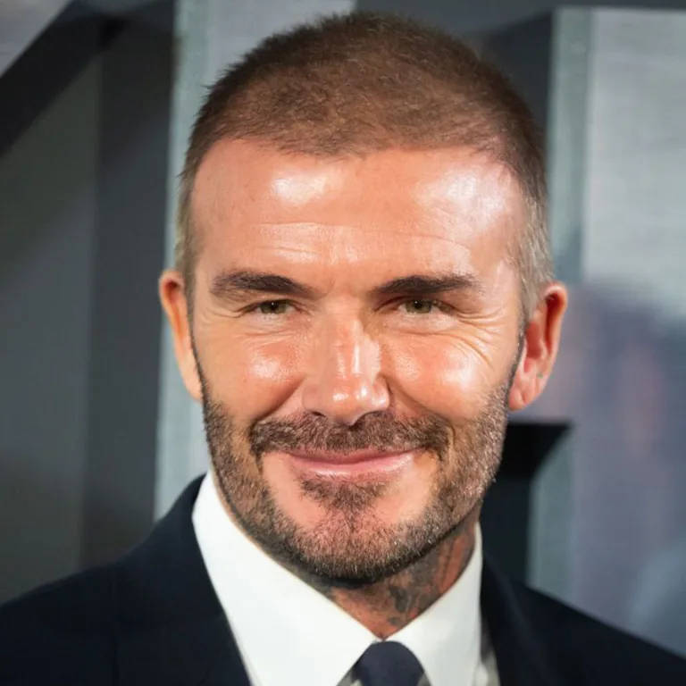 David Beckham Hair Restoration