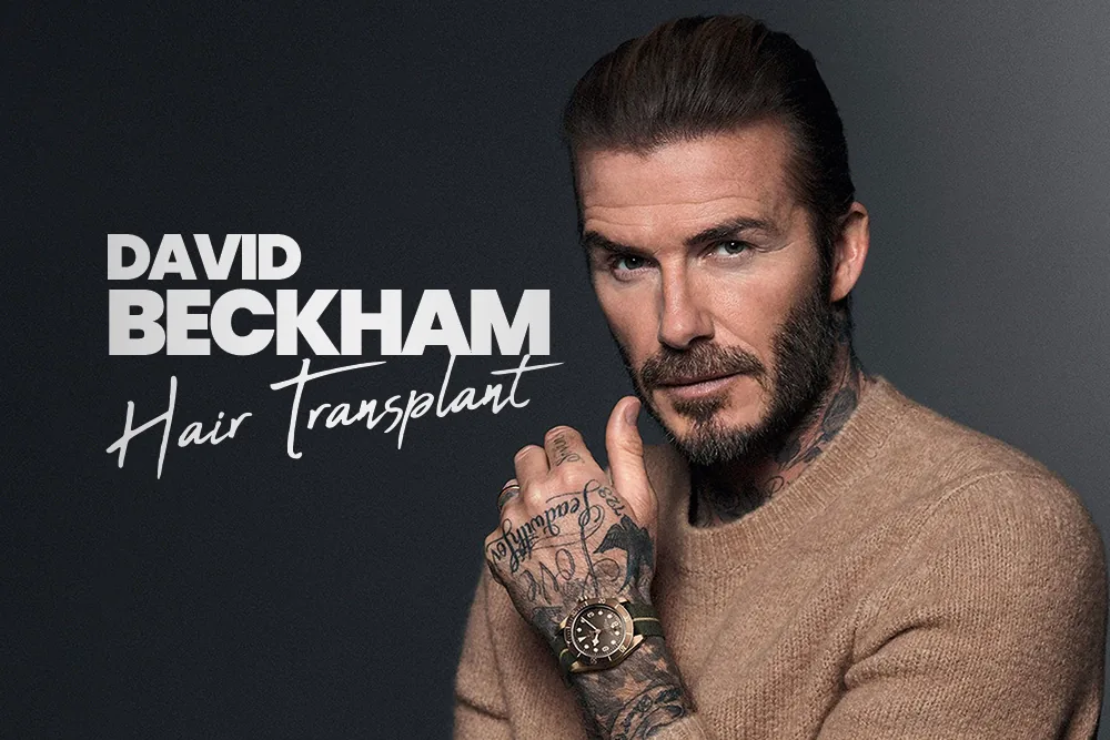 David Beckham Hair Transplant
