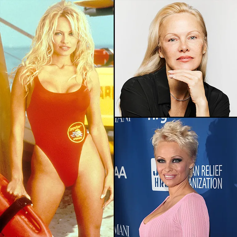 Did Pamela Anderson Get Botox Her Wrinkle-Free Look Explained