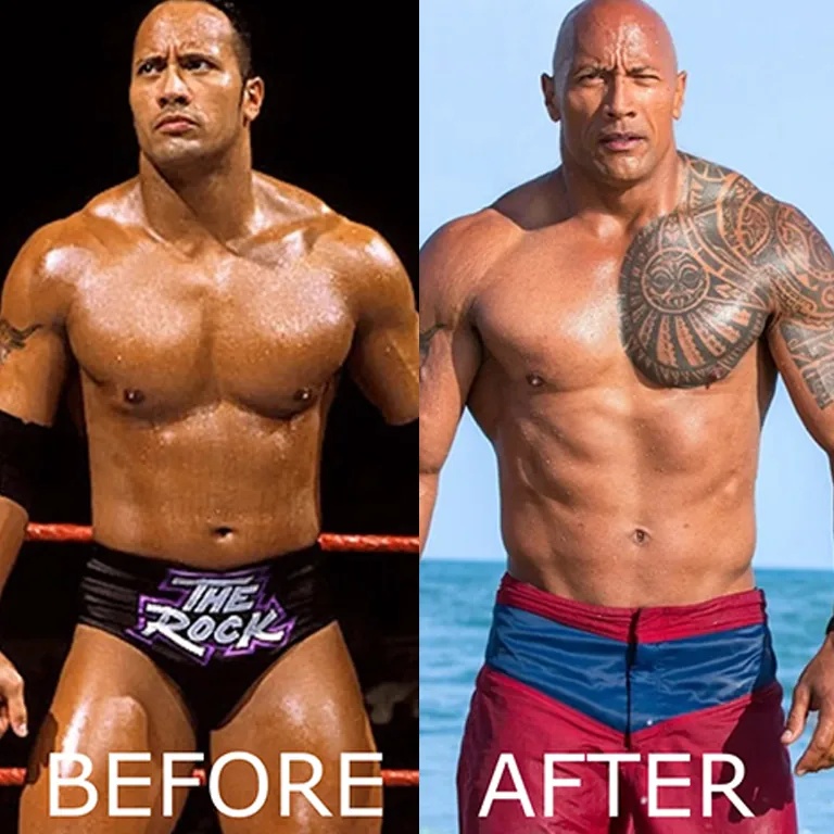 Did Steroid Use Cause Dwayne Johnson’s Gynecomastia