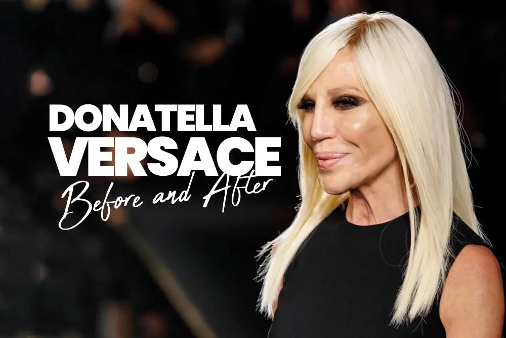 Donatella Versace Before and After