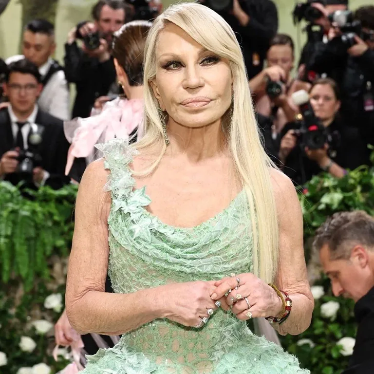 Donatella Versace Plastic Surgery Costs A High-End Investment