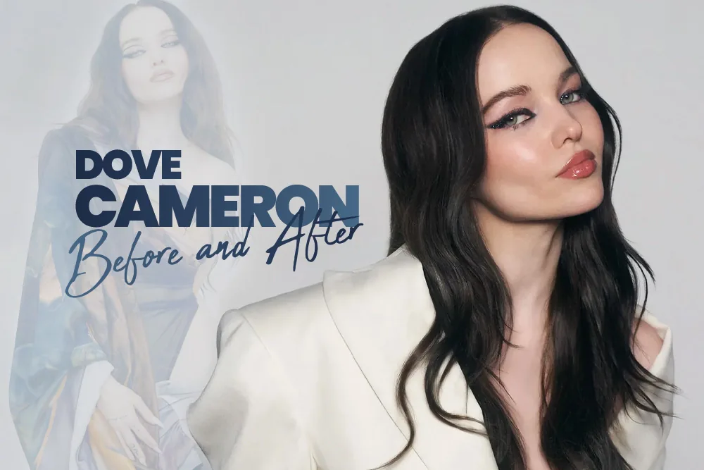 Dove Cameron Before and After