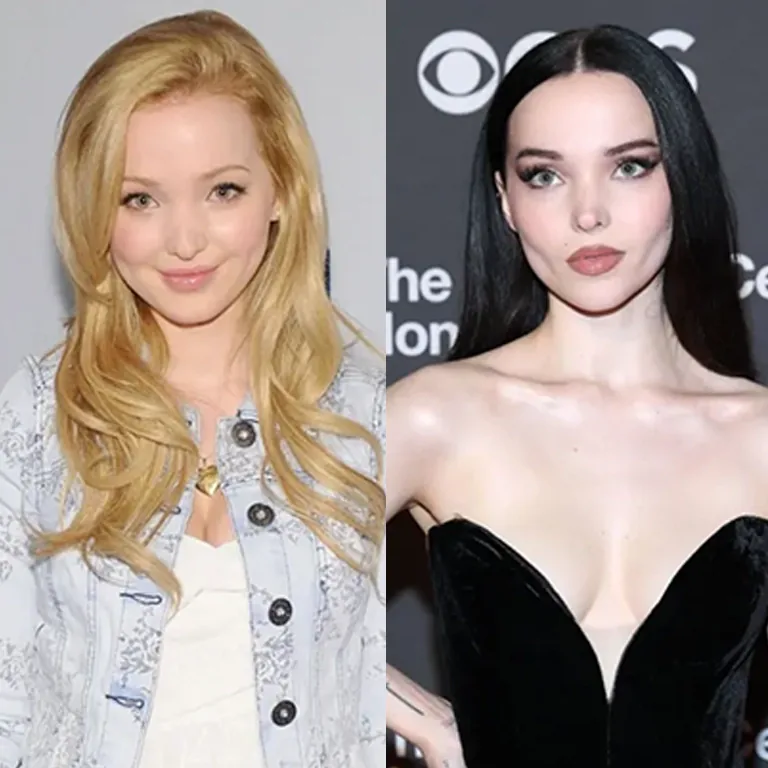 Dove Cameron Plastic Surgery Costs What’s the Price Tag