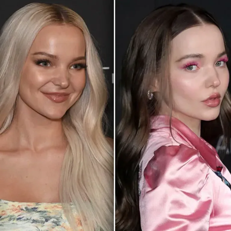 Dove Cameron Skin Glow Laser Treatments, Chemical Peels, or Natural Skincare