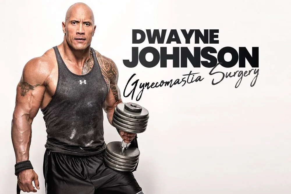 Dwayne Johnson Gynecomastia Surgery