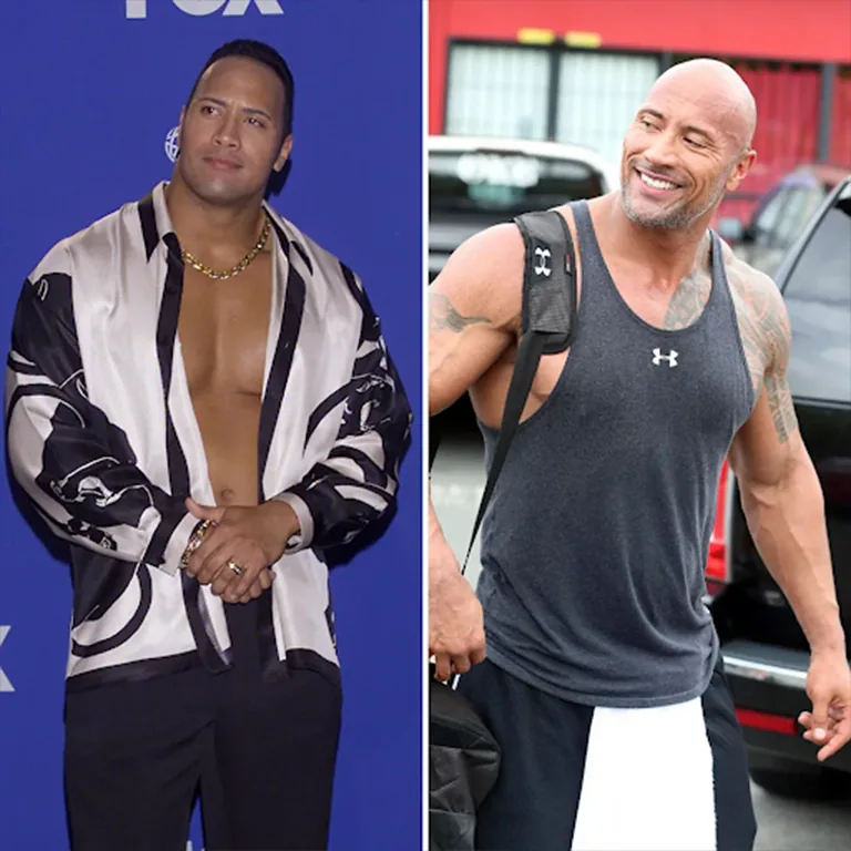 Dwayne Johnson Surgery Cost A Price for Confidence