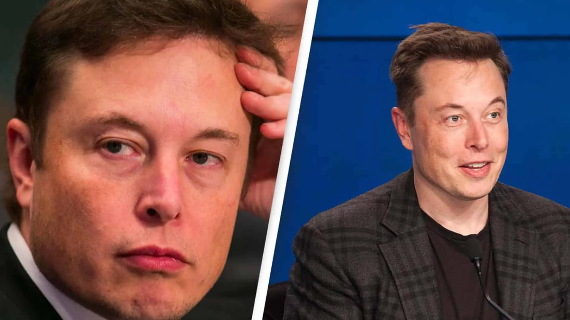 Elon Musk Plastic Surgery Costs