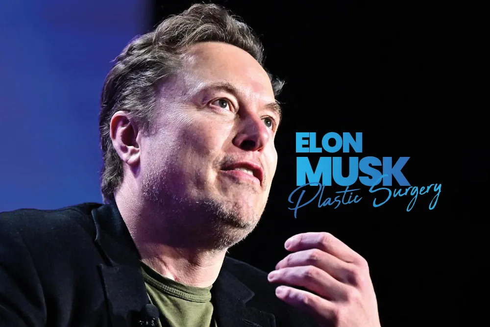 Elon Musk Plastic Surgery