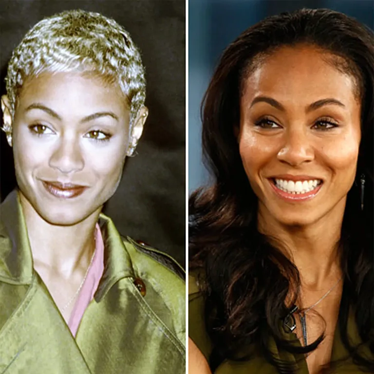 Jada Pinkett Smith Plastic Surgery Rumors and Reality