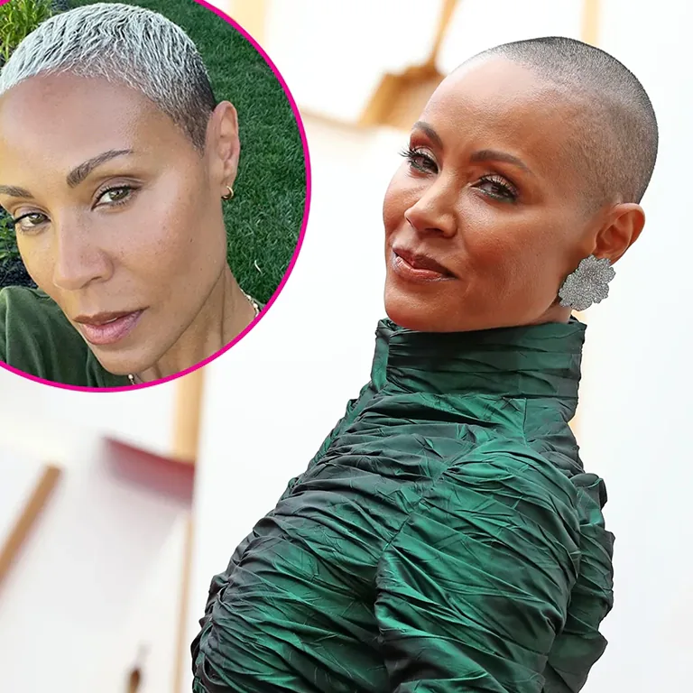 Jada Pinkett Smith’s Eyebrow Lift Framing the Face
