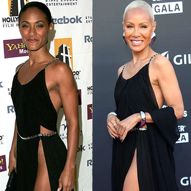 Jada Pinkett Smith’s Jawline Transformation Sculpted Elegance
